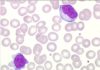 Cellules sanguines et hématopoïèse