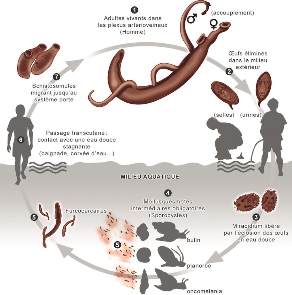 schistosomiasis bilharziose)