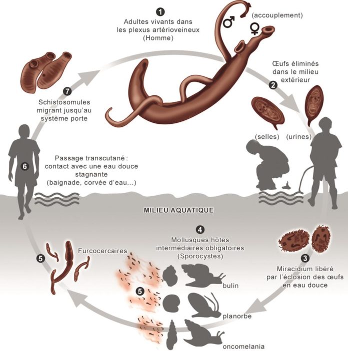 Schistosomiase - Bilharziose